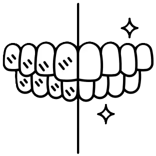 Zoom Whitening