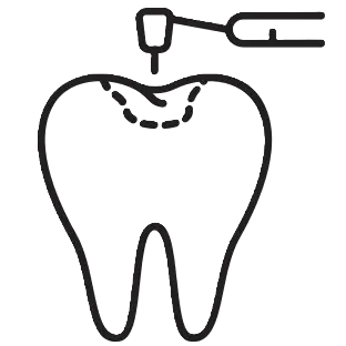 Fillings & Sealants